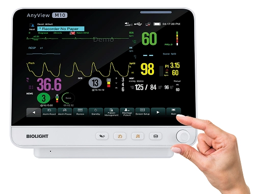 AnyView M10